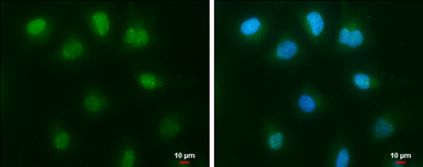 Anti-c-Abl antibody used in Immunocytochemistry/ Immunofluorescence (ICC/IF). GTX111317