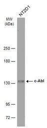 Anti-c-Abl antibody used in Western Blot (WB). GTX111317