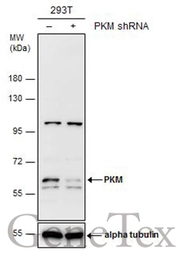 Anti-PKM antibody used in Western Blot (WB). GTX111319