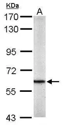Anti-PKM antibody used in Western Blot (WB). GTX111319