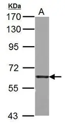 Anti-PKM antibody used in Western Blot (WB). GTX111319