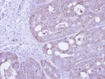 Anti-PKM antibody used in IHC (Paraffin sections) (IHC-P). GTX111319
