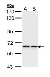 Anti-PKM antibody used in Western Blot (WB). GTX111319