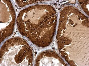 Anti-BTG1 antibody used in IHC (Paraffin sections) (IHC-P). GTX111321