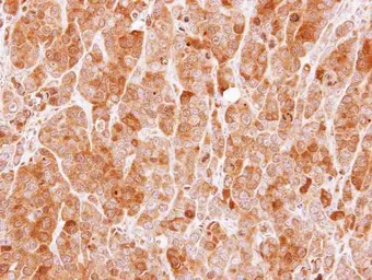 Anti-MVD antibody used in IHC (Paraffin sections) (IHC-P). GTX111324