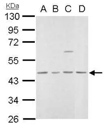 Anti-MVD antibody used in Western Blot (WB). GTX111324