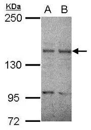 Anti-Ret antibody [N3C1], Internal used in Western Blot (WB). GTX111327