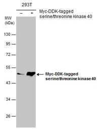 Anti-STK40 antibody [N3C3] used in Western Blot (WB). GTX111337