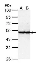 Anti-STK40 antibody [N3C3] used in Western Blot (WB). GTX111337