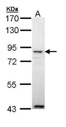 Anti-Angiopoietin 4 antibody [N1N3] used in Western Blot (WB). GTX111353