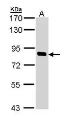 Anti-SCYL1 antibody [N3C2], Internal used in Western Blot (WB). GTX111355