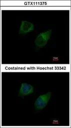 Anti-DGKG antibody [C1C3] used in Immunocytochemistry/ Immunofluorescence (ICC/IF). GTX111375