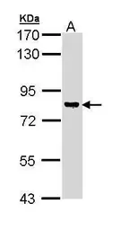 Anti-DGKG antibody [C1C3] used in Western Blot (WB). GTX111375