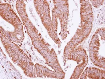 Anti-BCKDHA antibody [C1C3] used in IHC (Paraffin sections) (IHC-P). GTX111382