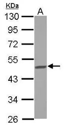 Anti-BCKDHA antibody [C1C3] used in Western Blot (WB). GTX111382
