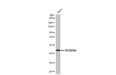 Anti-BCKDHA antibody [C1C3] used in Western Blot (WB). GTX111382