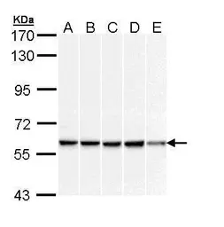 Anti-DNAJC3 antibody [C1C3] used in Western Blot (WB). GTX111383