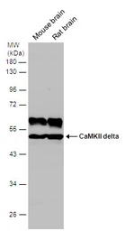 Anti-CaMKII delta antibody used in Western Blot (WB). GTX111401