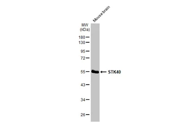 Anti-STK40 antibody [N1N3] used in Western Blot (WB). GTX111412
