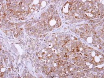 Anti-PASK antibody [C2C3-2], C-term used in IHC (Paraffin sections) (IHC-P). GTX111433