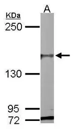 Anti-PASK antibody [C2C3-2], C-term used in Western Blot (WB). GTX111433