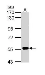 Anti-MPP2 antibody [C1C3] used in Western Blot (WB). GTX111438