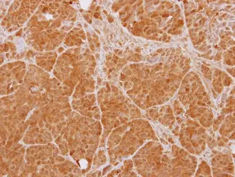 Anti-PTK9 antibody used in IHC (Paraffin sections) (IHC-P). GTX111439