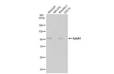 Anti-EphA1 antibody [C1C3-2] used in Western Blot (WB). GTX111449