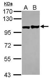 Anti-EphA1 antibody [C1C3-2] used in Western Blot (WB). GTX111449