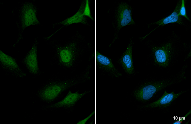 Anti-CLK3 antibody used in Immunocytochemistry/ Immunofluorescence (ICC/IF). GTX111451