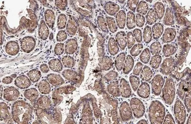 Anti-DDR1 antibody [N1N3] used in IHC (Paraffin sections) (IHC-P). GTX111453