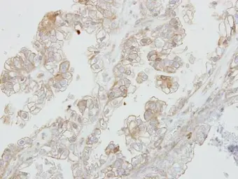 Anti-DDR1 antibody [N1N3] used in IHC (Paraffin sections) (IHC-P). GTX111453