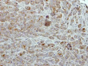 Anti-ULK2 antibody [C2C3], C-term used in IHC (Paraffin sections) (IHC-P). GTX111476