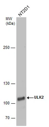 Anti-ULK2 antibody [C2C3], C-term used in Western Blot (WB). GTX111476