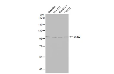 Anti-ULK2 antibody [C2C3], C-term used in Western Blot (WB). GTX111476