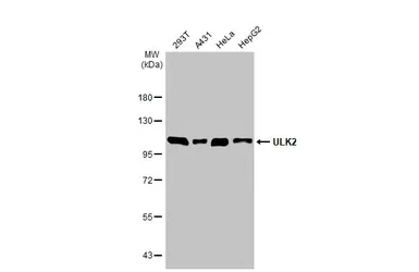 Anti-ULK2 antibody [C2C3], C-term used in Western Blot (WB). GTX111476