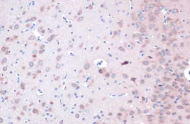 Anti-ULK2 antibody [C2C3], C-term used in IHC (Paraffin sections) (IHC-P). GTX111476