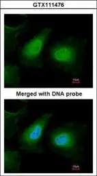 Anti-ULK2 antibody [C2C3], C-term used in Immunocytochemistry/ Immunofluorescence (ICC/IF). GTX111476