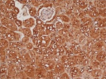 Anti-Presenilin 2 antibody used in IHC (Paraffin sections) (IHC-P). GTX11148