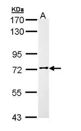 Anti-FASTKD3 antibody [C1C3-2] used in Western Blot (WB). GTX111480