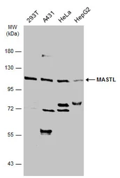 Anti-MASTL antibody used in Western Blot (WB). GTX111481
