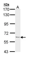 Anti-Ubiquilin 1 antibody [N1C1] used in Western Blot (WB). GTX111485