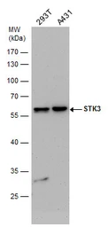 Anti-STK3 antibody used in Western Blot (WB). GTX111494