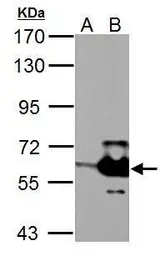 Anti-STK3 antibody used in Western Blot (WB). GTX111494