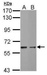 Anti-STK3 antibody used in Western Blot (WB). GTX111494