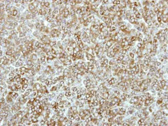 Anti-eEF2K antibody [N1N3] used in IHC (Paraffin sections) (IHC-P). GTX111496