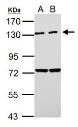 Anti-PKN2 antibody used in Western Blot (WB). GTX111499