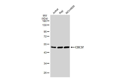 Anti-CDC37 antibody used in Western Blot (WB). GTX111510