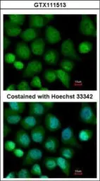 Anti-CASK antibody used in Immunocytochemistry/ Immunofluorescence (ICC/IF). GTX111513