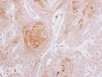 Anti-MYLK2 antibody [N3C3-2] used in IHC (Paraffin sections) (IHC-P). GTX111514